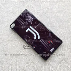 ເຄສທັງໝົດ