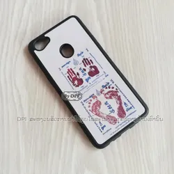 ເຄສທັງໝົດ